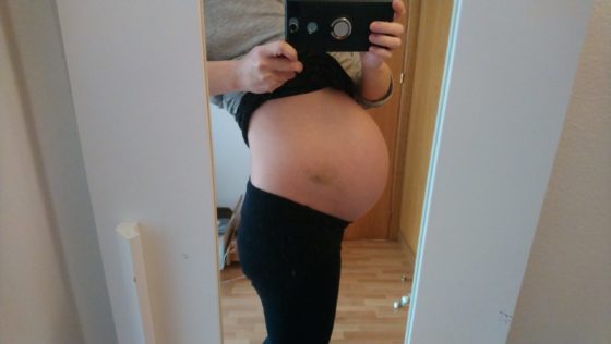妊娠38週5日　お腹　不育症　写真　横